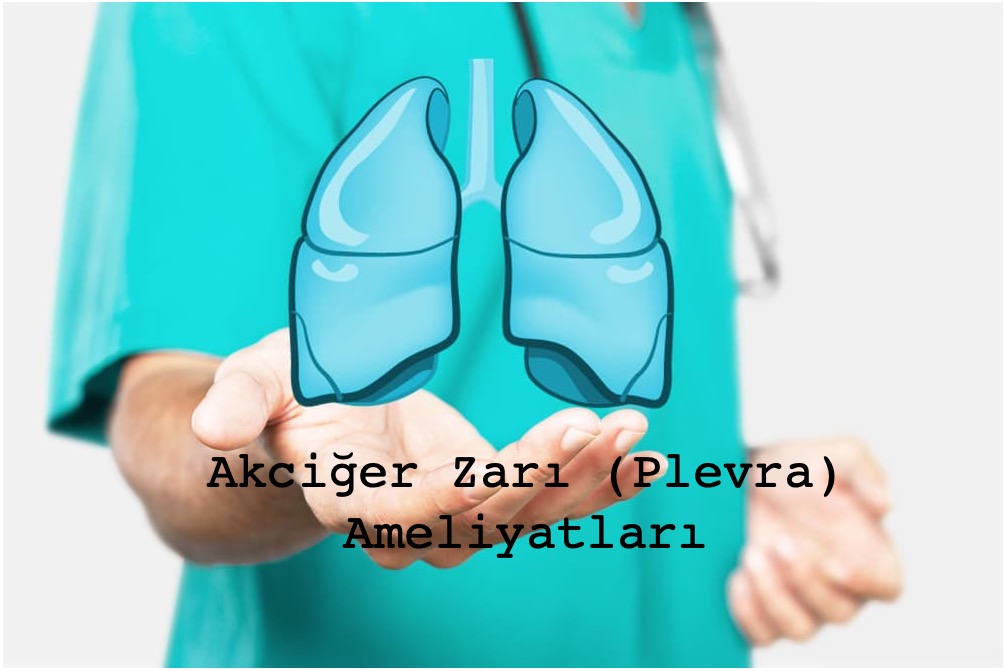 Akciğer Zarı Ameliyatları