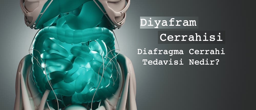 Diyafram Cerrahisi