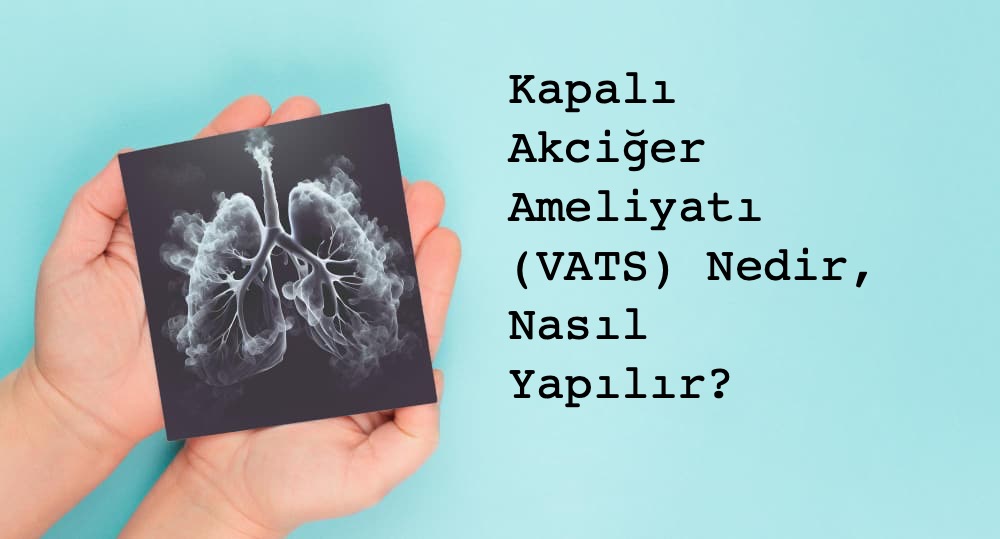 Torakoskopik İşlemler (VATS)