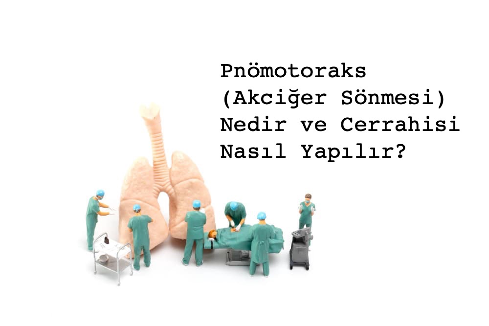 Plevra (Akciğer Zarı) Cerrahisi