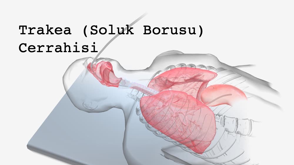 Trakea Cerrahisi
